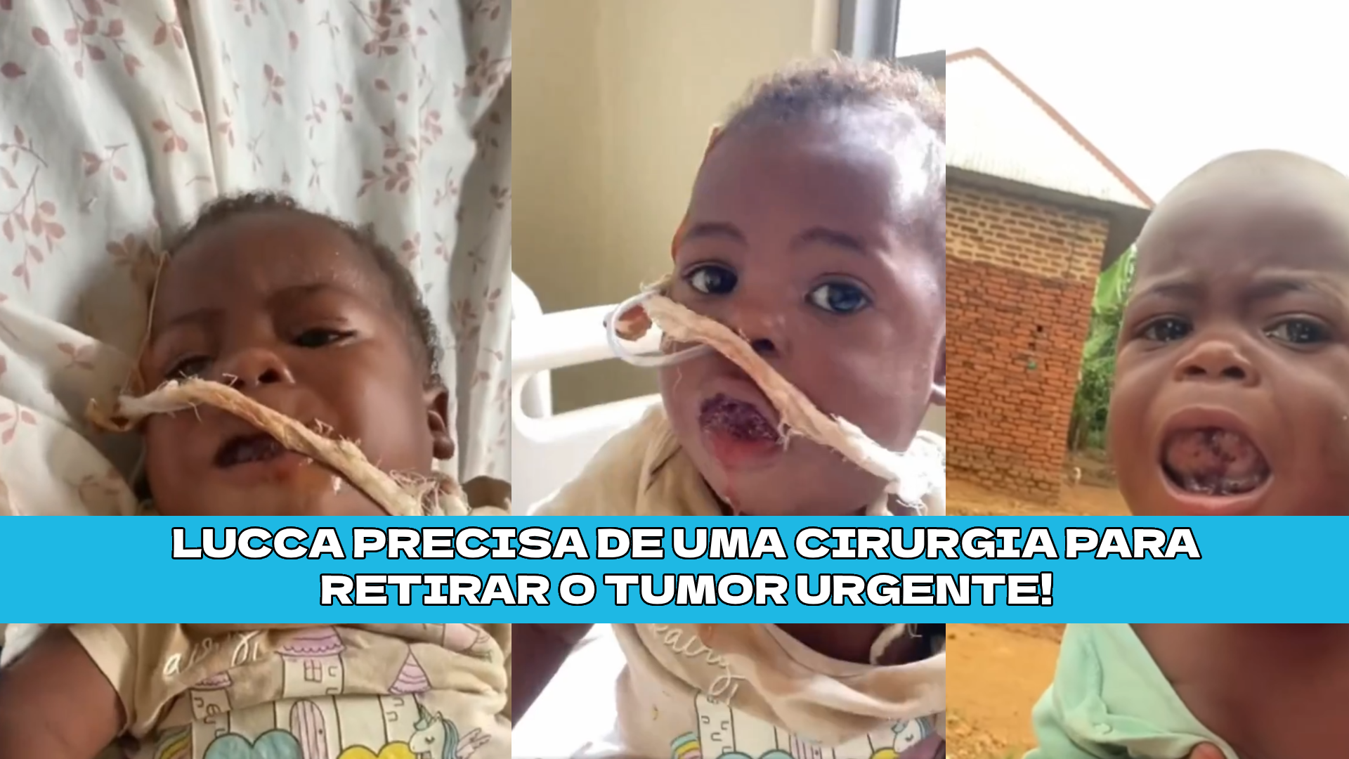 Ajude o Lucca a remover tumor da boca